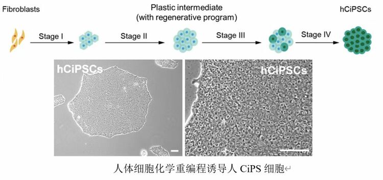 ヒトＣｉＰＳ細胞（化学的誘導多能性幹細胞）の作製プロセスを示した図（資料写真）。(c)Xinhua News