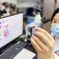 中国・重慶の医療用ＡＩ、顕微鏡検査の代替も視野に